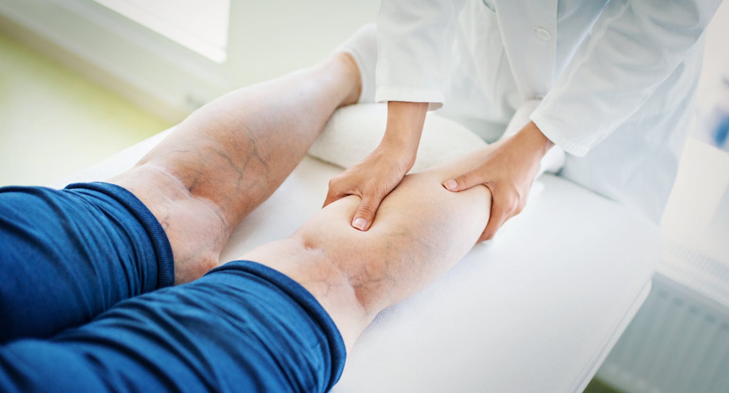 Qu'est-ce que l'angiologie ?