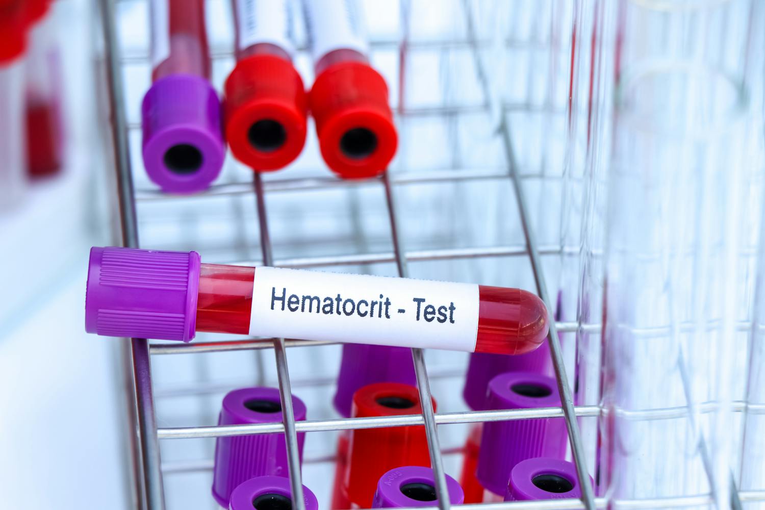 Qu'est-ce que l'hématocrite ?